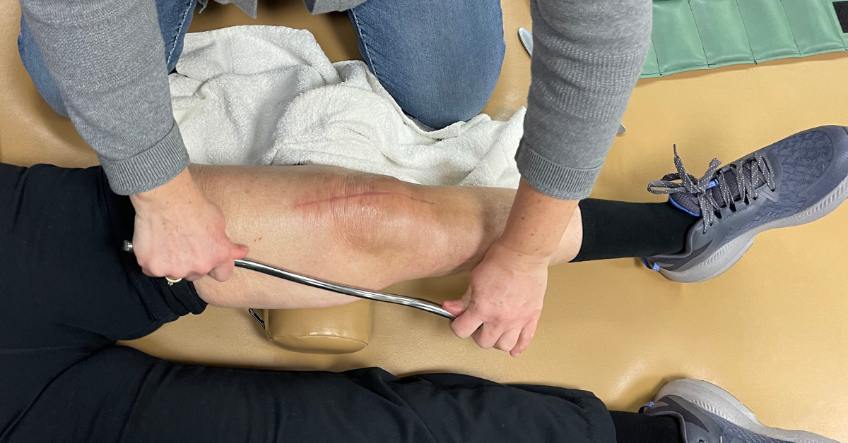 IASTM Method provides a mobilizing effect to scar tissue and myofascial adhesions.